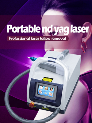 Portable nd yag laser tattoo removal machine